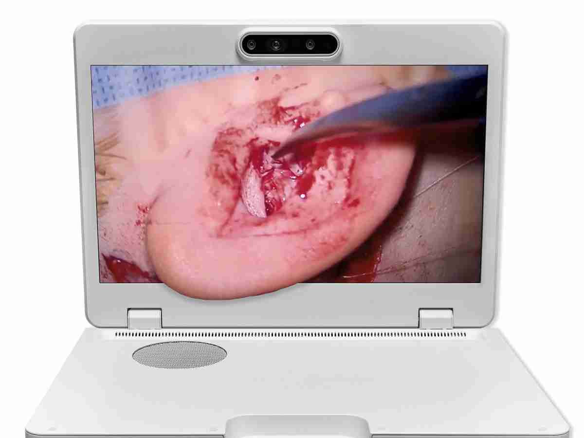 达擎之＂Heads-up 3D显微手术显示系统＂，，，，整合4K裸眼3D显示及眼球追踪系统，，，具备快速追踪人眼移动位置功能，，减轻医师长时间维持固定姿势的负担，，让医师能有更宽广清晰的3D立体视野及更舒适的姿势来执行手术。。。。